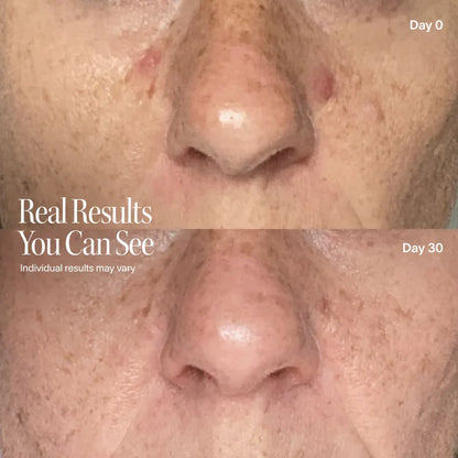 LumaRitual 2.0 Face & Neck Mask